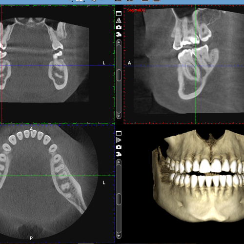 CBCT Dental Scan in Bagphat