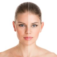 Skin Rejuvenation Treatment in Baghpat