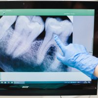 dental-xray-in-baghpat