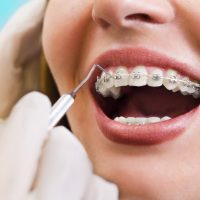 orthodontist in baghpat